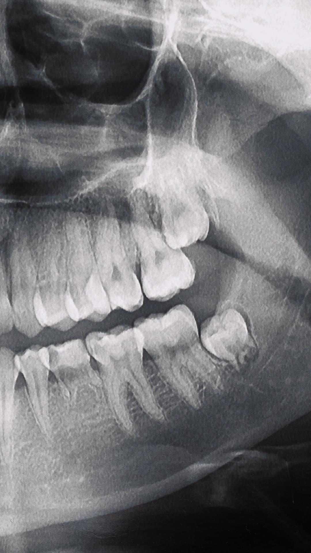 Imágenes dentales Curridabat Odontokinética