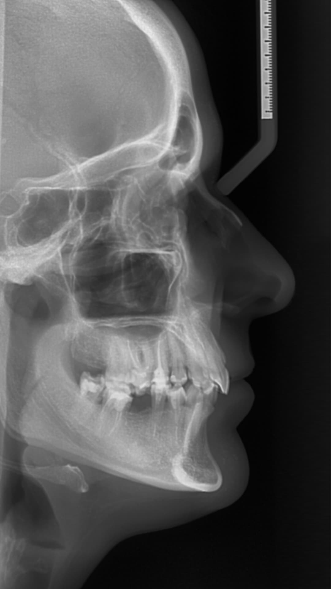 Tomografía dental 3D Odontokinética