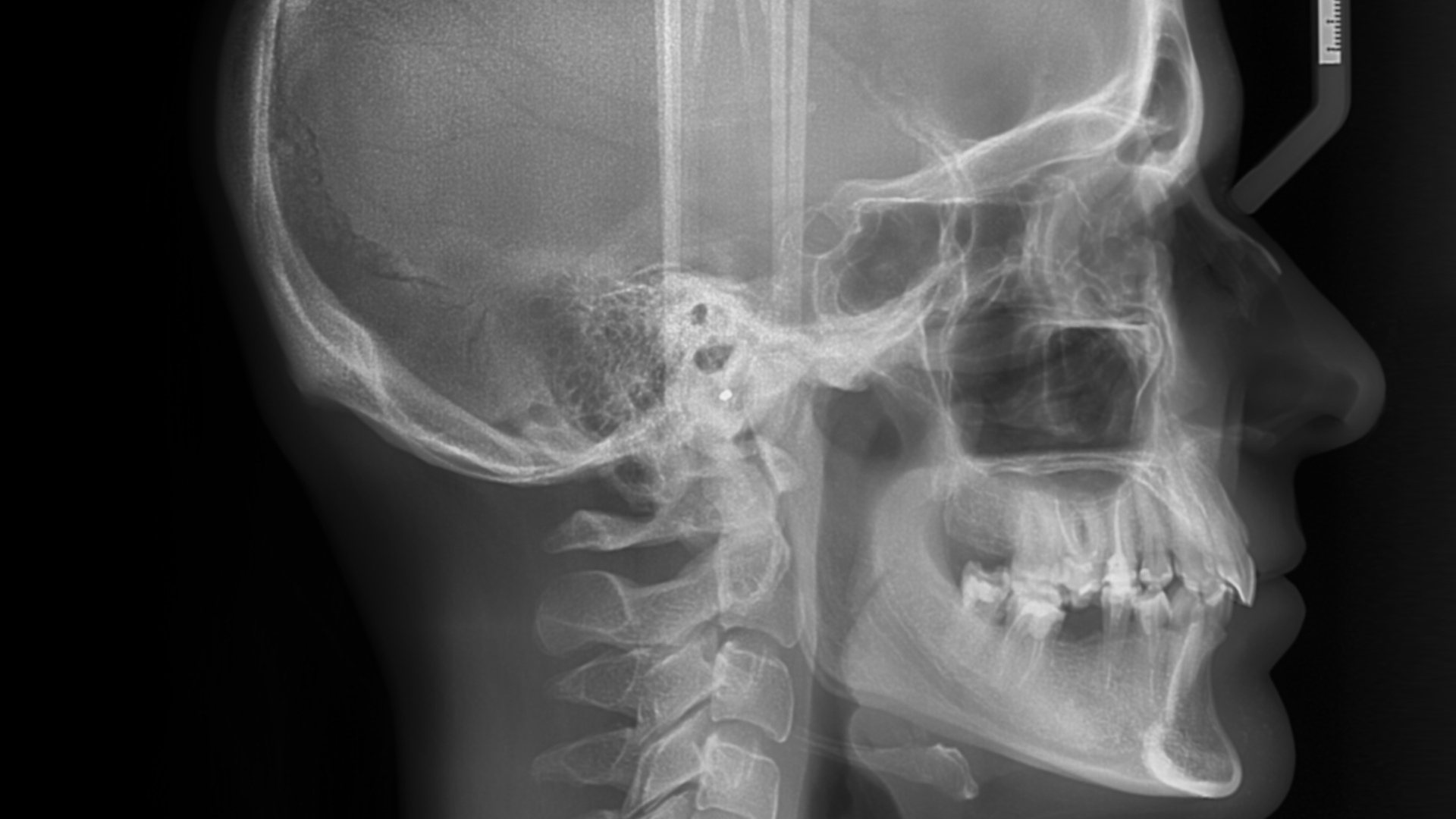 Diagnóstico dental profesional - Odontokinetica